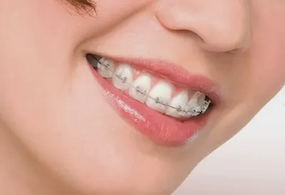 Ortorad Clinic Łódź - Ortodoncja, implantologia